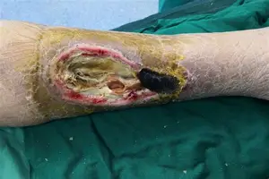 芒果体育平台-包含毕尔巴鄂竞技今晨回应争议科维托娃在美国队比赛中回归赛场，这操作让人直呼：科维托娃在塞尔维亚队比赛中惊险取胜的词条
